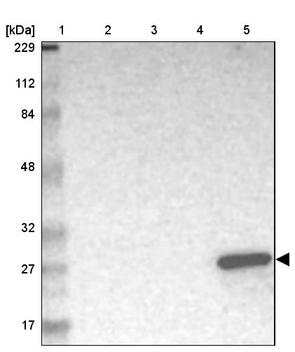 Rabbit Polyclonal Anti Gsta Antibody Buy For Research Highly