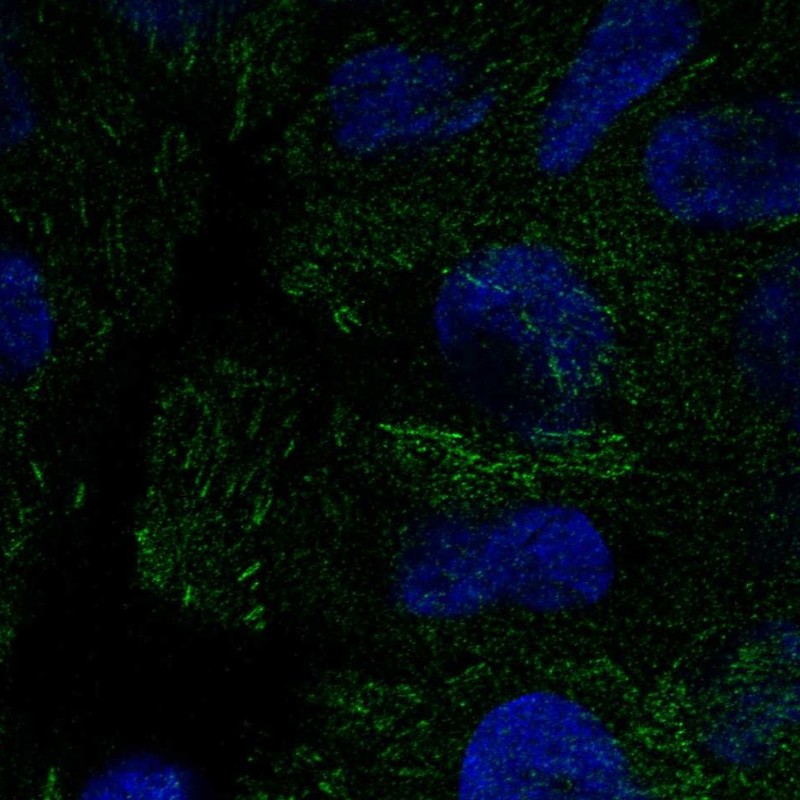 Rabbit Polyclonal Anti Peak Antibody Buy For Research Highly