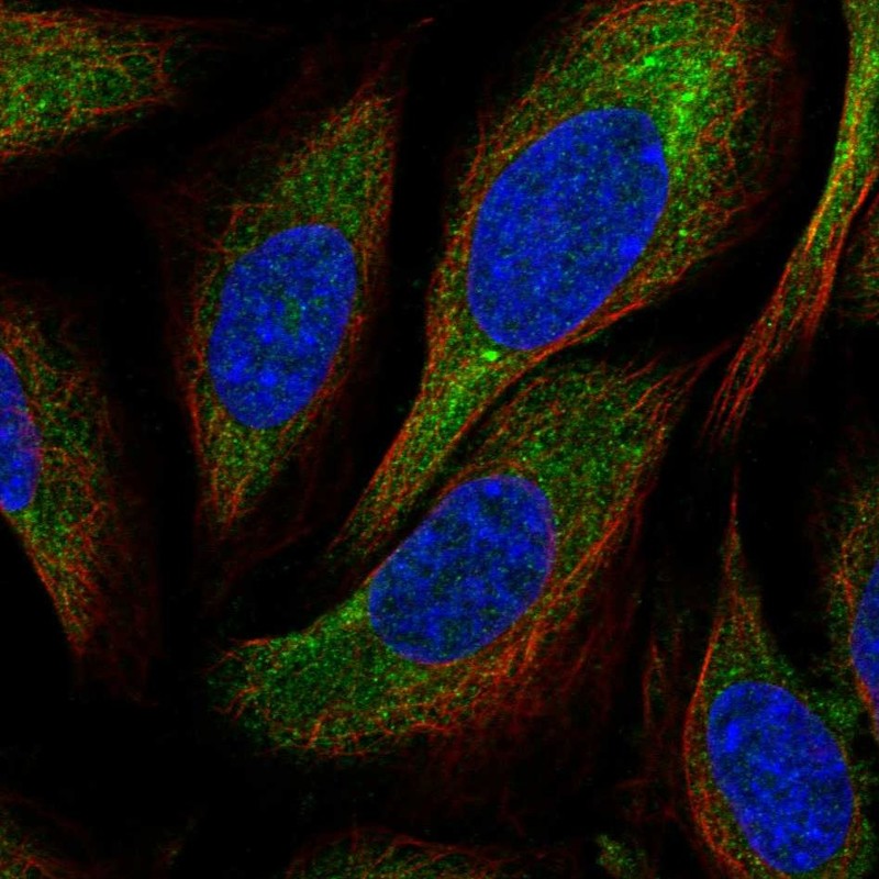 Rabbit Polyclonal Anti Cnot Antibody Buy For Research Highly