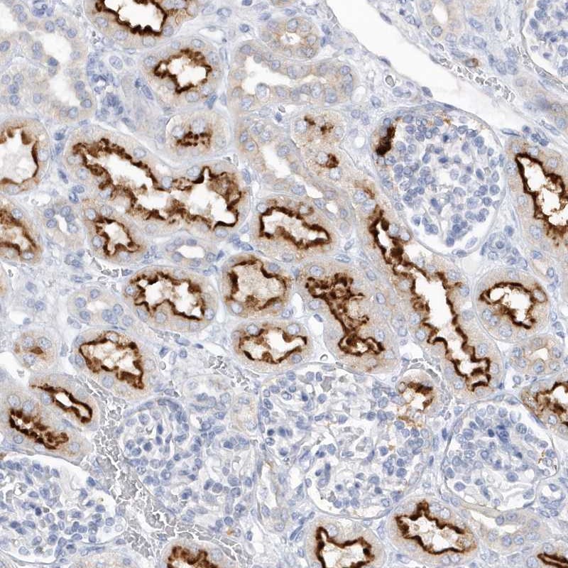 Rabbit Polyclonal Anti Rpe Antibody Buy For Research Highly