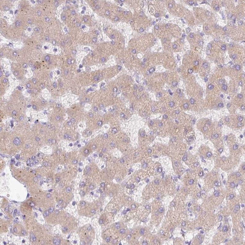 Rabbit Polyclonal Anti C A Antibody Buy For Research Highly