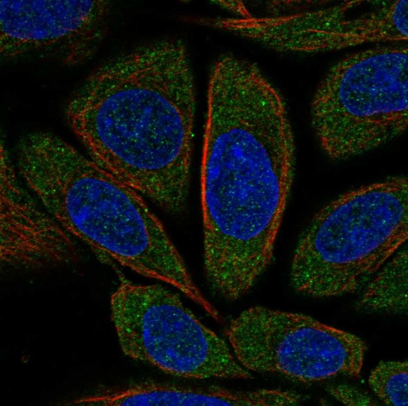 Rabbit Polyclonal Anti Cnot Antibody Buy For Research Highly