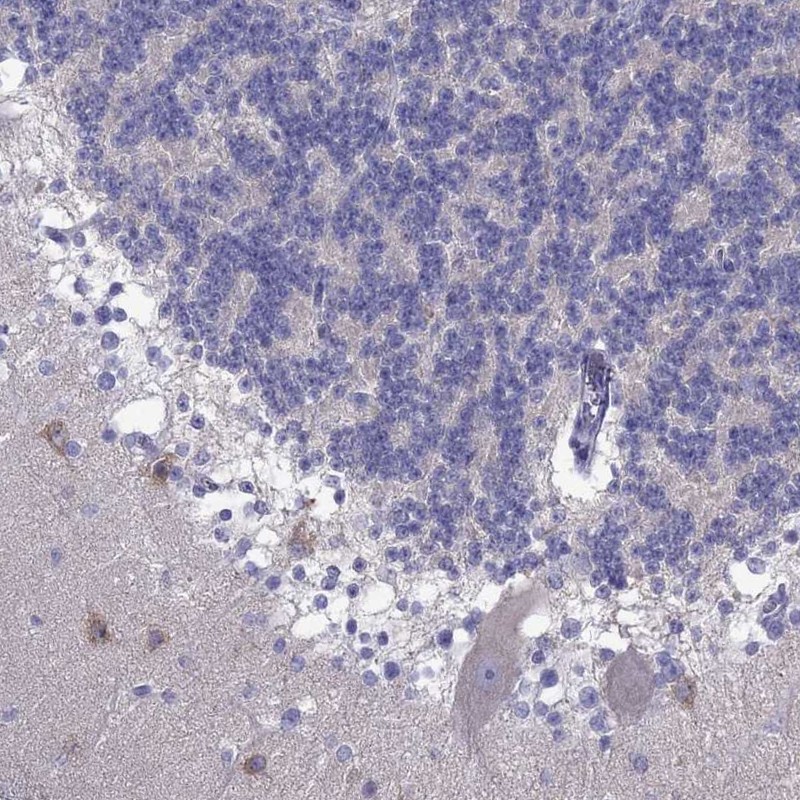 Rabbit Polyclonal Anti Pcdha Antibody Buy For Research Highly