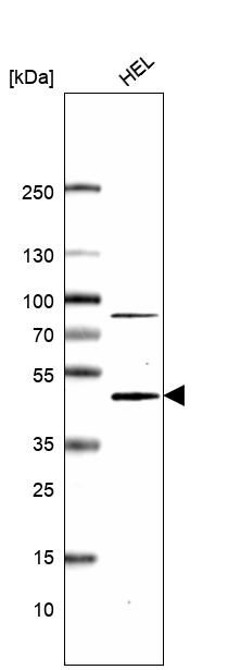 Mouse Monoclonal Anti Cmpk Antibody Buy For Research Highly