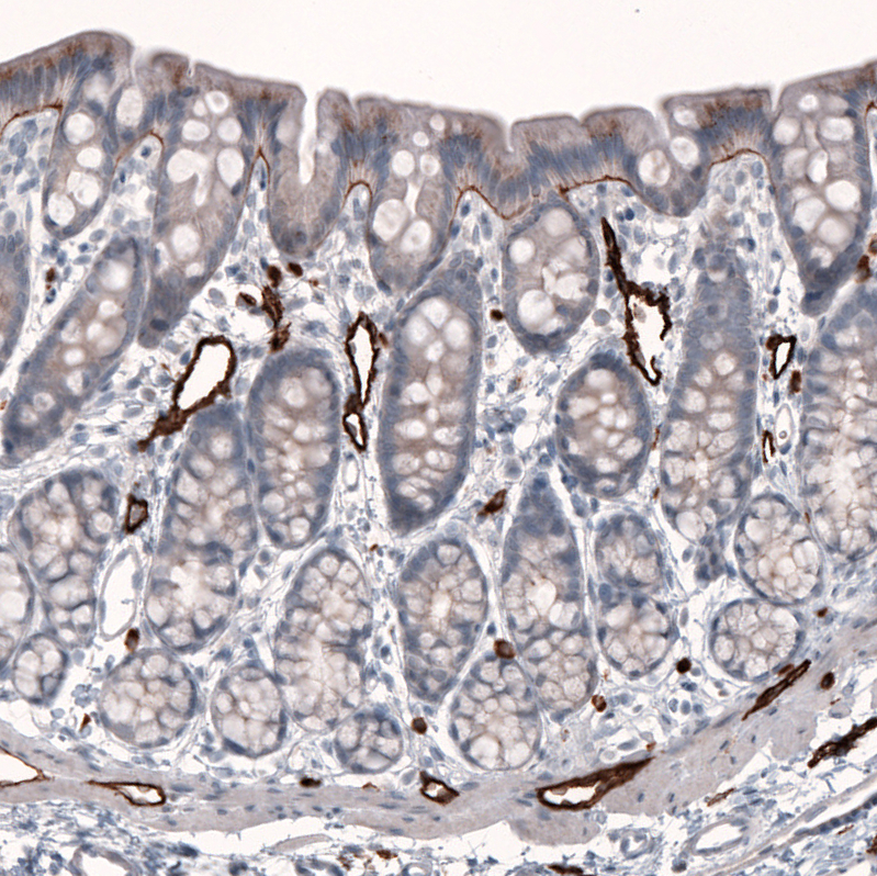 Anti-LAMB3 Antibody