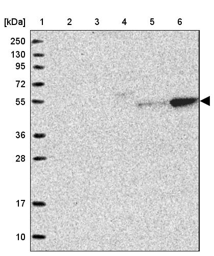 Rabbit Polyclonal Anti Pla2g15 Antibody Buy For Research Highly Specific Rigorously 2479