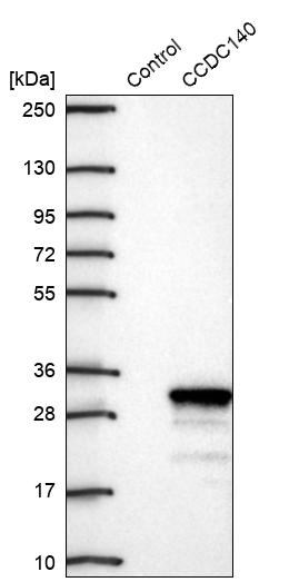 Rabbit Polyclonal Anti Ccdc140 Antibody Buy For Research Highly Specific Rigorously 5314