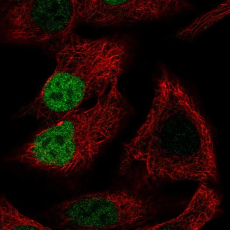 Rabbit Polyclonal Anti Morc4 Antibody Buy For Research Highly Specific Rigorously Validated 8829