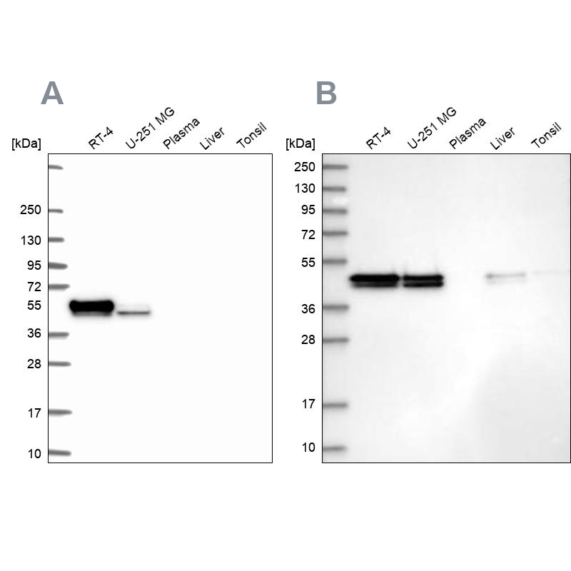 Rabbit Polyclonal Anti Rcn1 Antibody Buy For Research Highly Specific Rigorously Validated 8061