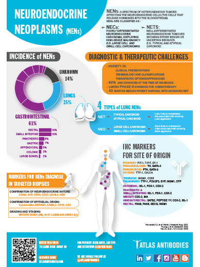 Infographic: Neuroendocrine Neoplasms Markers