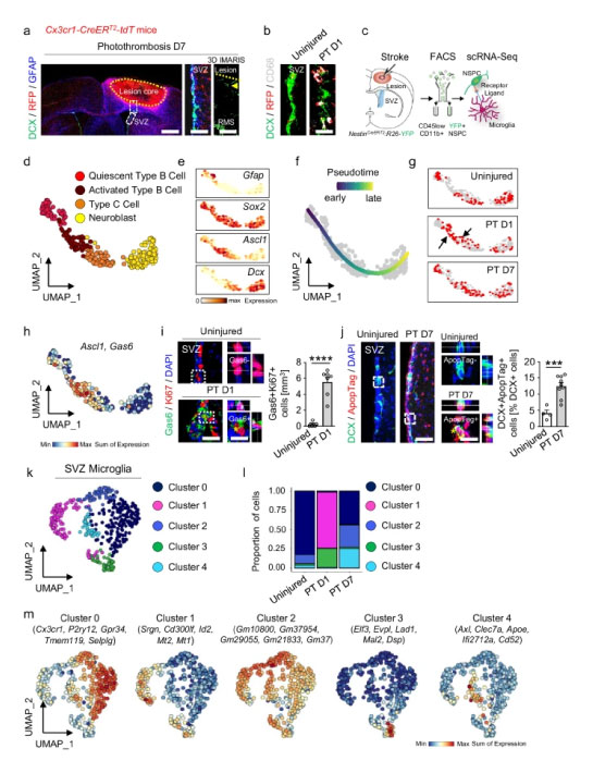 Role of microglia in brain repair after stroke.