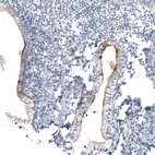 Immunohistochemical staining of human cervix, uterine shows moderate membranous positivity in glandular cells.