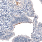 Immunohistochemical staining of human fallopian tube shows moderate positivity in cilia in glandular cells.