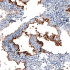 Immunohistochemical staining of human endometrium shows strong membranous positivity in glandular cells.