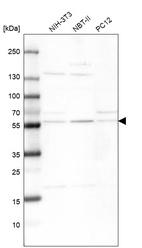 Anti-XPNPEP3 Antibody