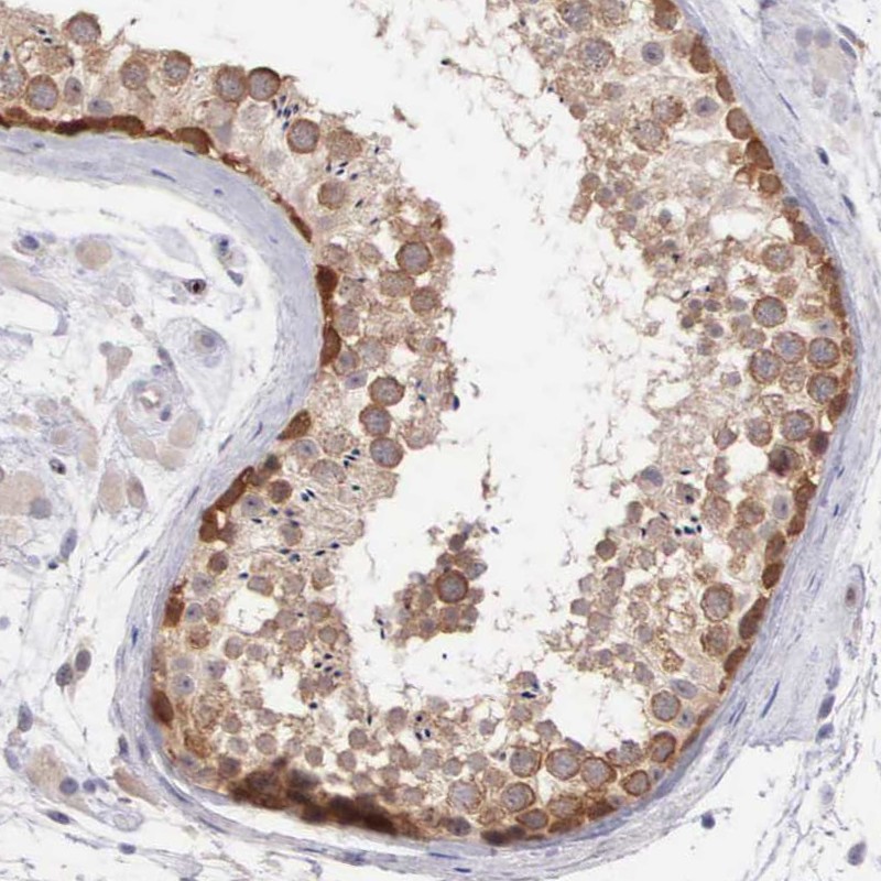 Anti-DNAJB7 Antibody