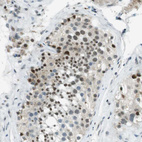 Immunohistochemical staining of human testis shows strong nuclear positivity in cells in seminiferous ducts.