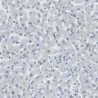 Immunohistochemical staining of human liver shows no positivity in hepatocytes as expected.