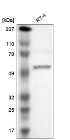 Western blot analysis in human cell line RT-4.