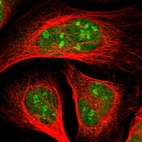 Immunofluorescent staining of human cell line U-2 OS shows localization to nucleus & nucleoli.