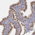 Anti-WDR13 Antibody