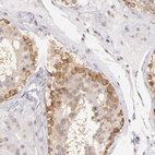 Anti-IMPDH2 Antibody