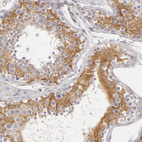 Immunohistochemical staining of human testis shows moderate cytoplasmic positivity in cells in seminiferous ducts.