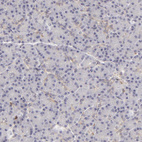 Immunohistochemical staining of human pancreas shows no positivity as expected.