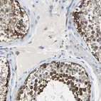 Immunohistochemical staining of human testis shows strong membranous and cytoplasmic positivity in cells in seminiferous ducts.