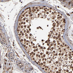 Anti-NXF2B Antibody