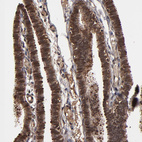 Anti-NXF2B Antibody