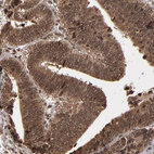 Anti-NXF2B Antibody