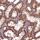 Immunohistochemical staining of human kidney shows moderate to strong granular cytoplasmic positivity in cells in tubules.