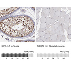 Anti-SIPA1L1 Antibody