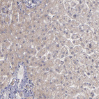 Anti-SIPA1L1 Antibody