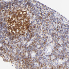 Anti-LRMP Antibody