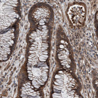 Anti-PLXNB2 Antibody