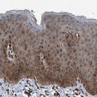 Anti-PLXNB2 Antibody