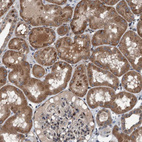 Anti-PLXNB2 Antibody