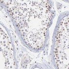 Anti-ZNF773 Antibody