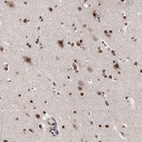 Anti-ZNF777 Antibody