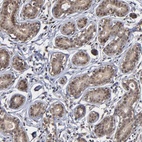 Anti-ZNF419 Antibody