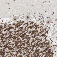 Anti-CUX1 Antibody