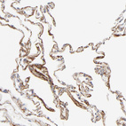 Anti-LTBP2 Antibody