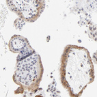 Immunohistochemical staining of human placenta shows moderate positivity in extracellular space in trophoblastic cells.