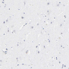 Immunohistochemical staining of human cerebral cortex shows no positivity in neurons as expected.