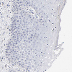 Immunohistochemical staining of human skin shows no positivity in squamous epithelial cells as expected.