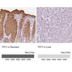 Anti-TFF1 Antibody