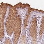 Immunohistochemical staining of human stomach shows high expression.