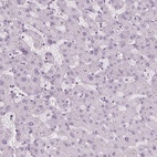 Immunohistochemical staining of human liver shows low expression as expected.